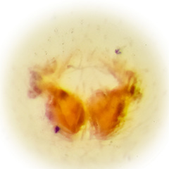 Psellonus sp. "Common White" © Joseph K H Koh  • Epigyne • Ventral • ♀ • Adult
